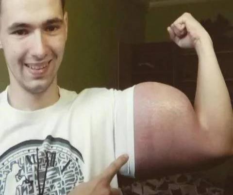 小伙为变身肌肉男注射药物,脸上表情却在诉说着后悔_看看头条_中华网
