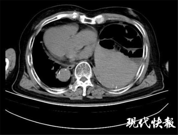 91 岁老人是 镜面人 所有内脏全部长反 看看头条 中华网