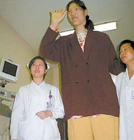 他从小患有侏儒症 去世时身高达2 41米 长高 秘诀 竟是这个 看看头条 中华网