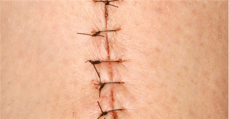 为什么想当空姐，身上却不能有一点疤呢？今天总算知道了