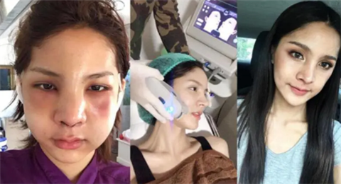 韩国男子为了逃避兵役竟选择变成女生太漂亮了2