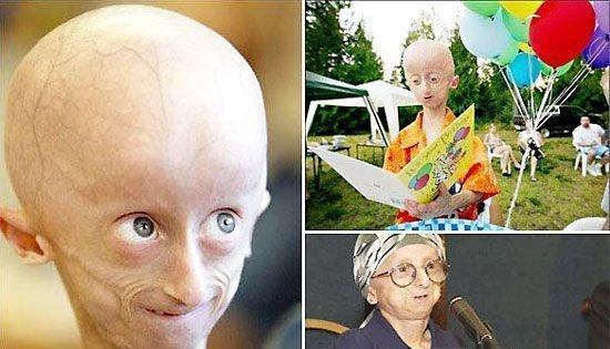 世界上真实存在的变异人胆小勿入3