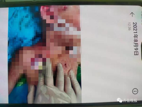 心疼！4岁女童被两条恶犬拖走、撕咬近20分钟……