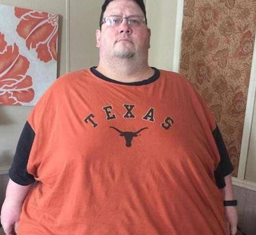 超胖父亲体重635斤为活着见到女儿结婚要减掉450斤2