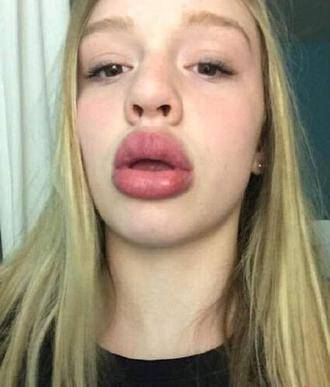 17岁女孩改造自己身体成世界上嘴唇最大的人2