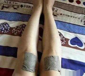 女友|出门才两天，女友就把膝盖摔破了，连忙回家照顾她