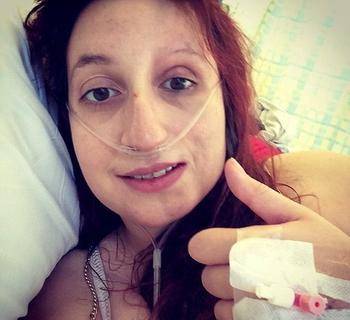 女孩患罕见病一半的脸萎缩全世界不到1000例