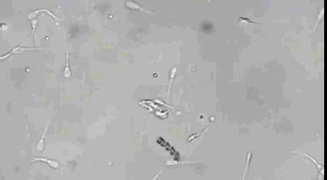 安吉丽娜|太凶残了国外反人类一键素颜APP千万不要在国内上架心疼安吉丽娜