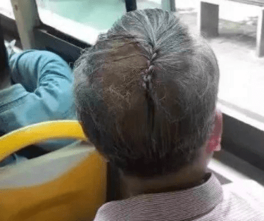 脑袋瓜子|脑袋瓜子，是不是有点嗡嗡嗡的响啊