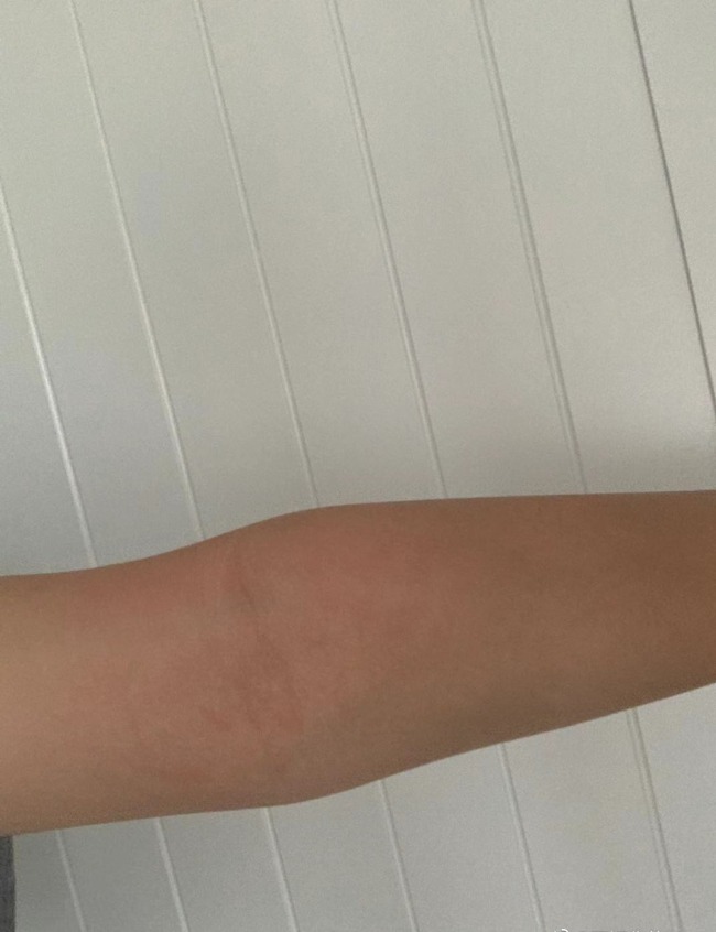 女儿伤痕照曝光前妻斥李阳编造谎言掩盖暴力行为